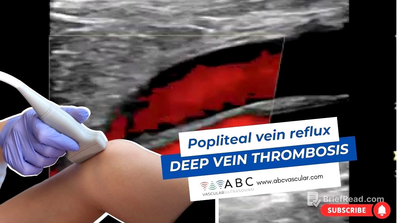 Popliteal vein reflux after deep vein thrombosis | Ultrasound