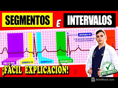 Electrocardiograma : Ondas, Segmentos e Intervalos
