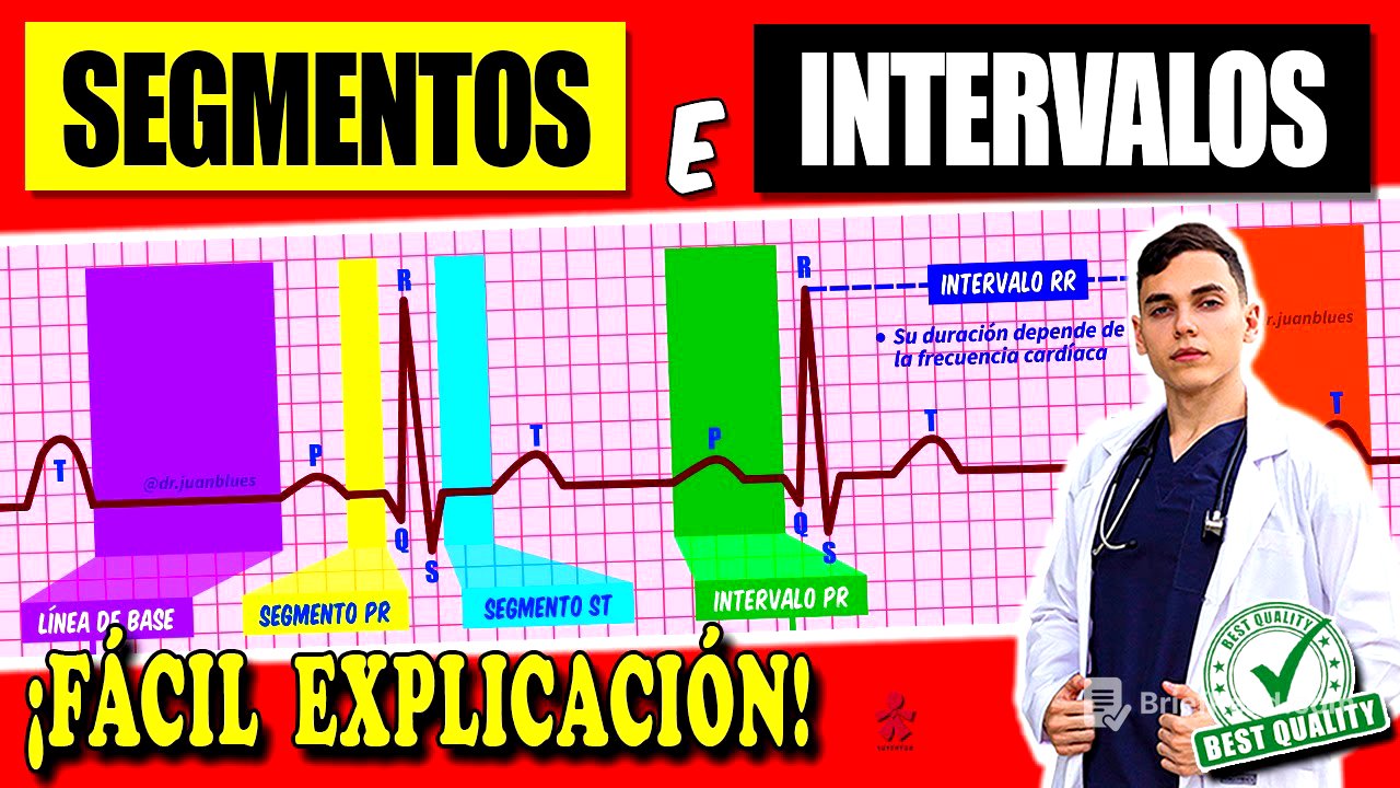 Electrocardiograma : Ondas, Segmentos e Intervalos