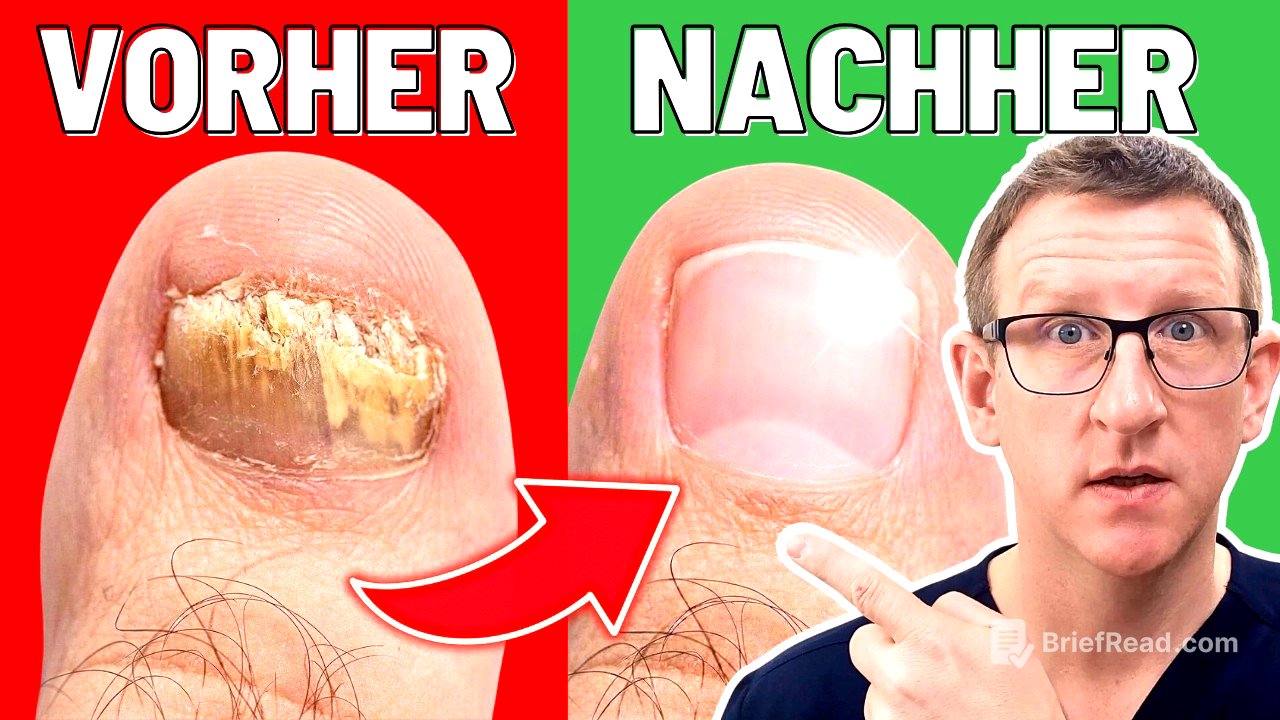 Nagelpilz - dieses Hausmittel wirkt BESSER als Chemie!