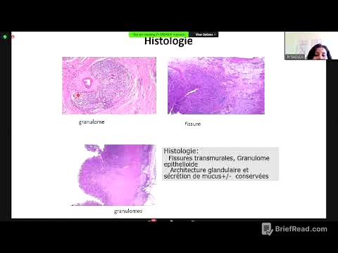 MICI -  Maladie de Crohn Pr Saoula - Cours officiel de la faculté de médecine d'Alger