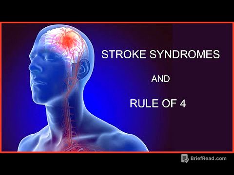 STROKE SYNDROMES AND RULE OF 4