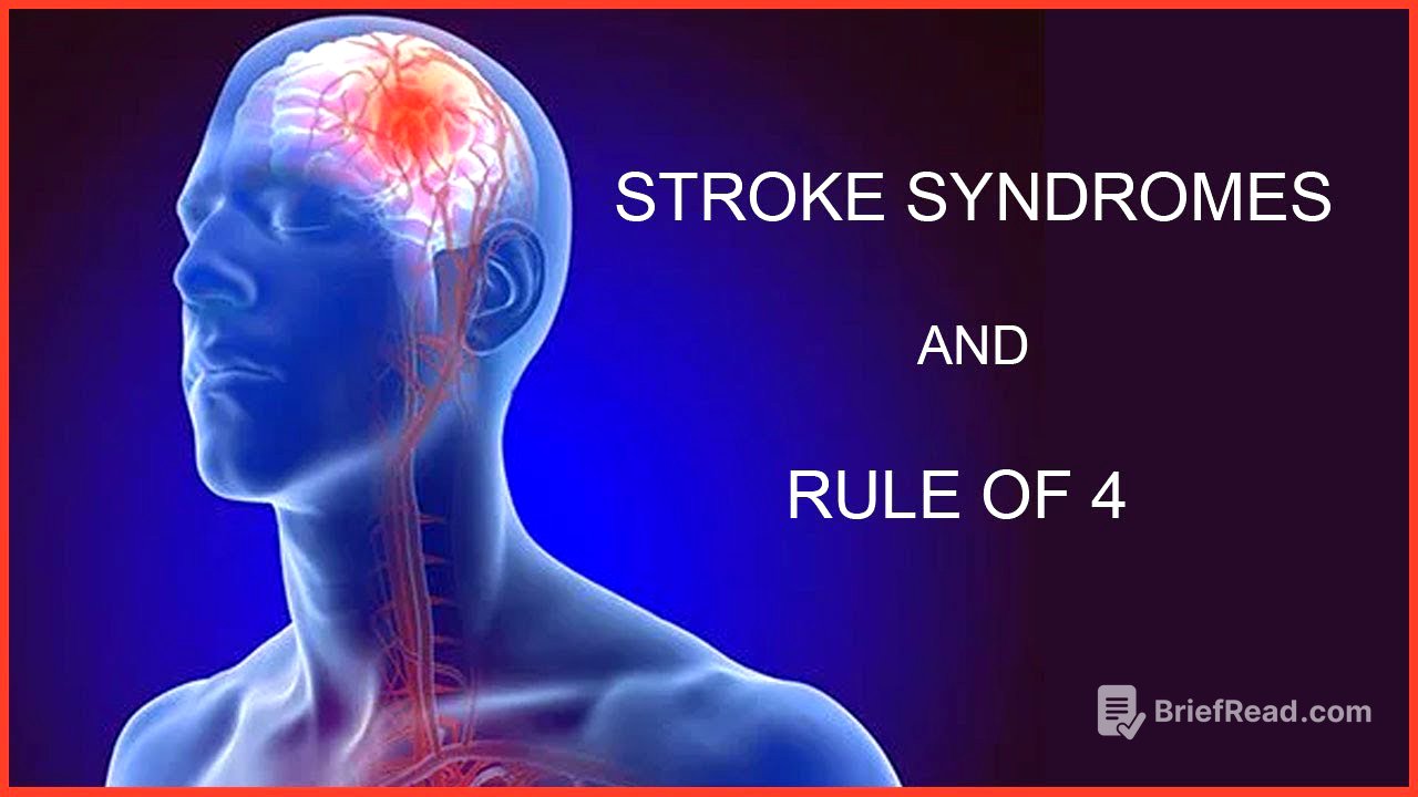 STROKE SYNDROMES AND RULE OF 4