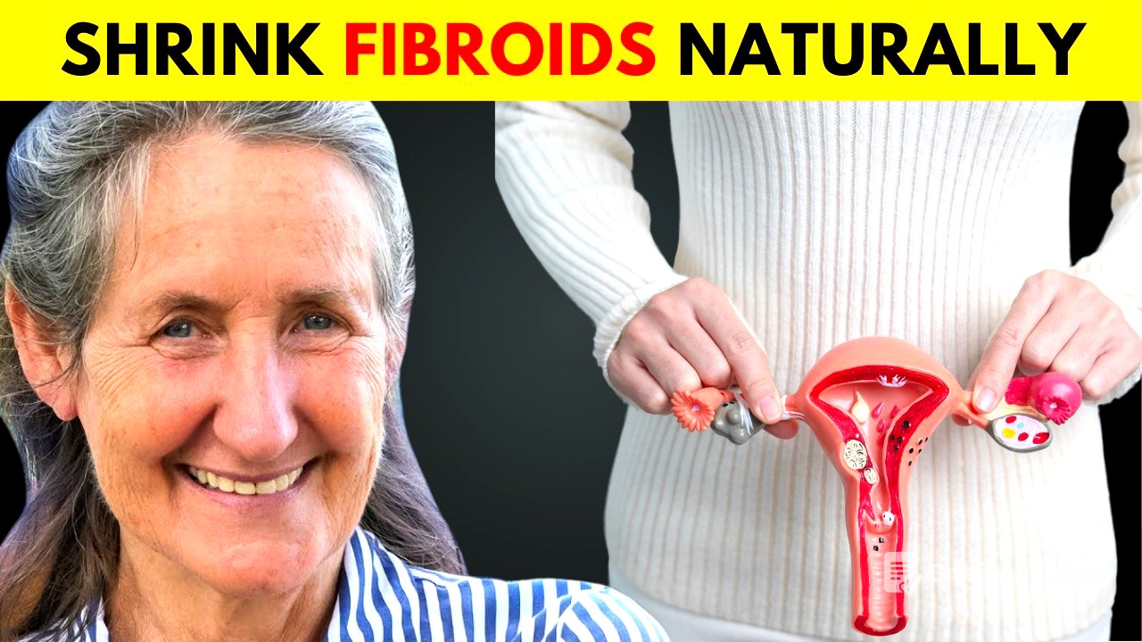 12 Foods That Shrink Fibroids (Naturally) | Barbara O’Neill