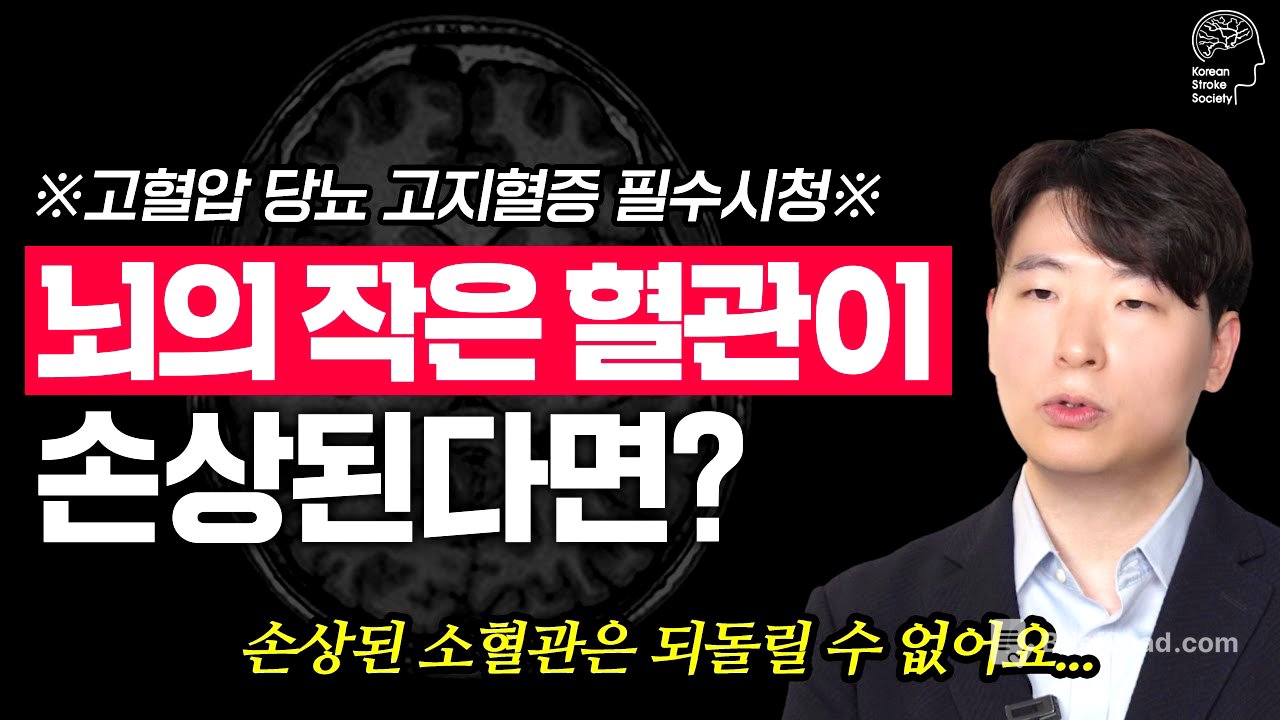 건강검진에서 발견된 '하얀 점'의 정체! 뇌졸중 전문의가 알려주는 소혈관 질환의 모든 것