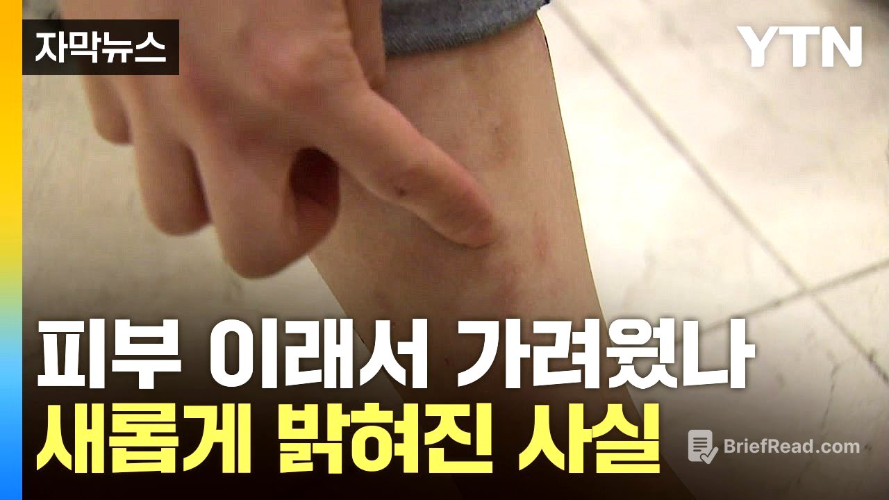 [자막뉴스] '원인 불명' 가려움증...수수께끼 퍼즐 풀렸다 / YTN