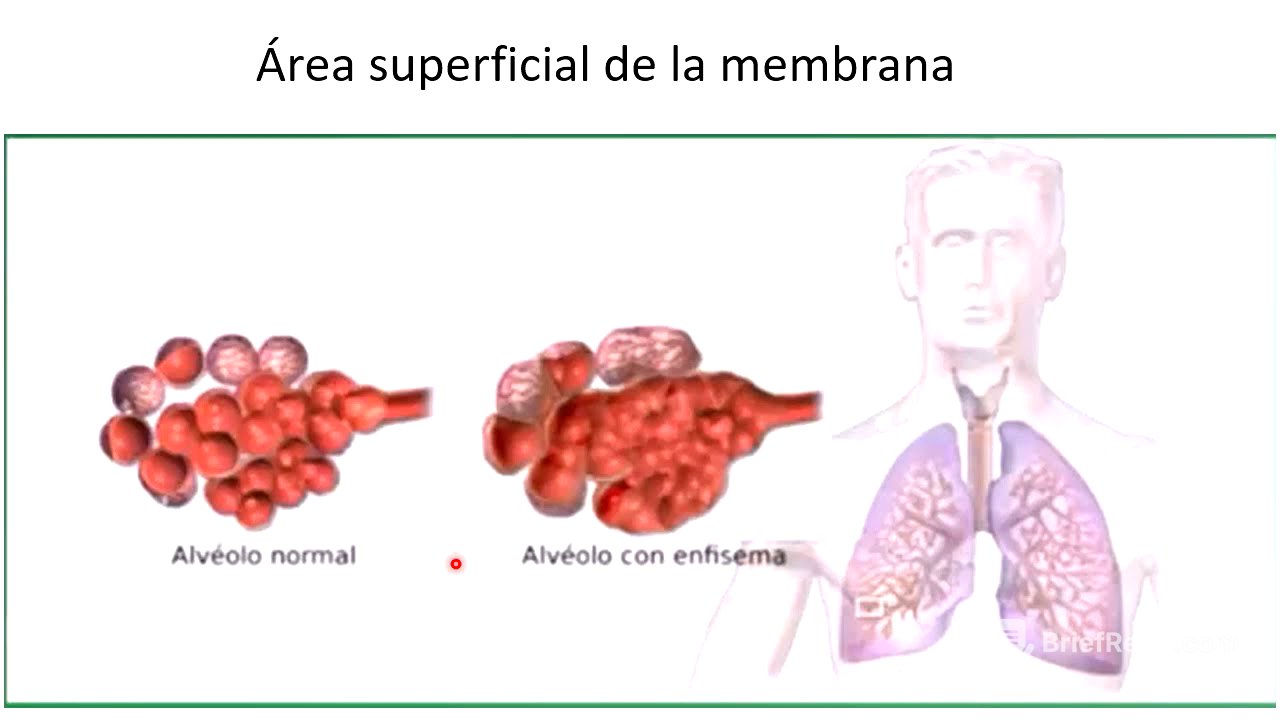 Intercambio de gases y transporte de O2 y CO2