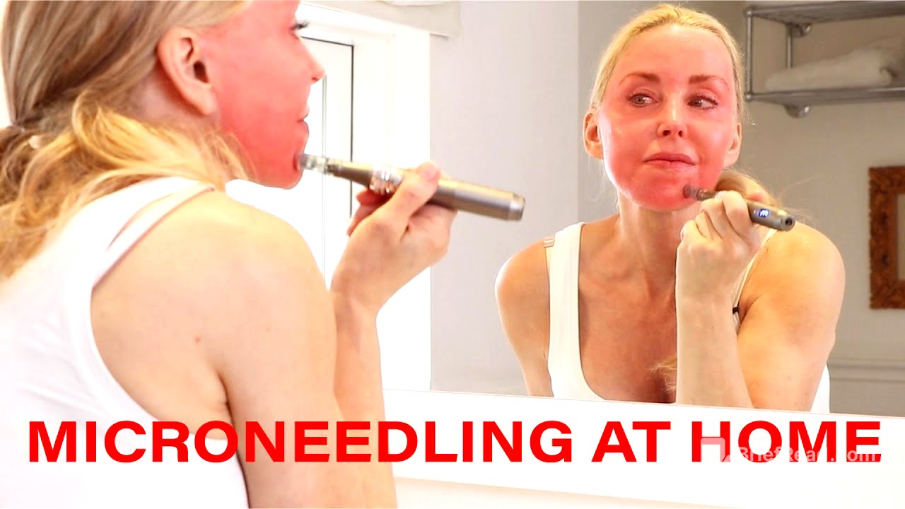 Microneedling DIY at Home - Tips, Warnings and Demo | Over 50