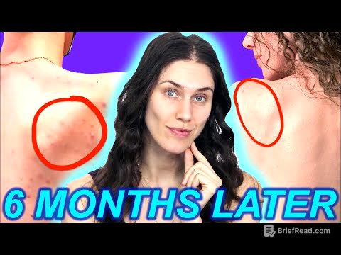 How I FINALLY Got my Body Acne to Behave...