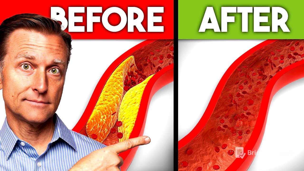 Best Nutrients to Remove Plaque from Arteries
