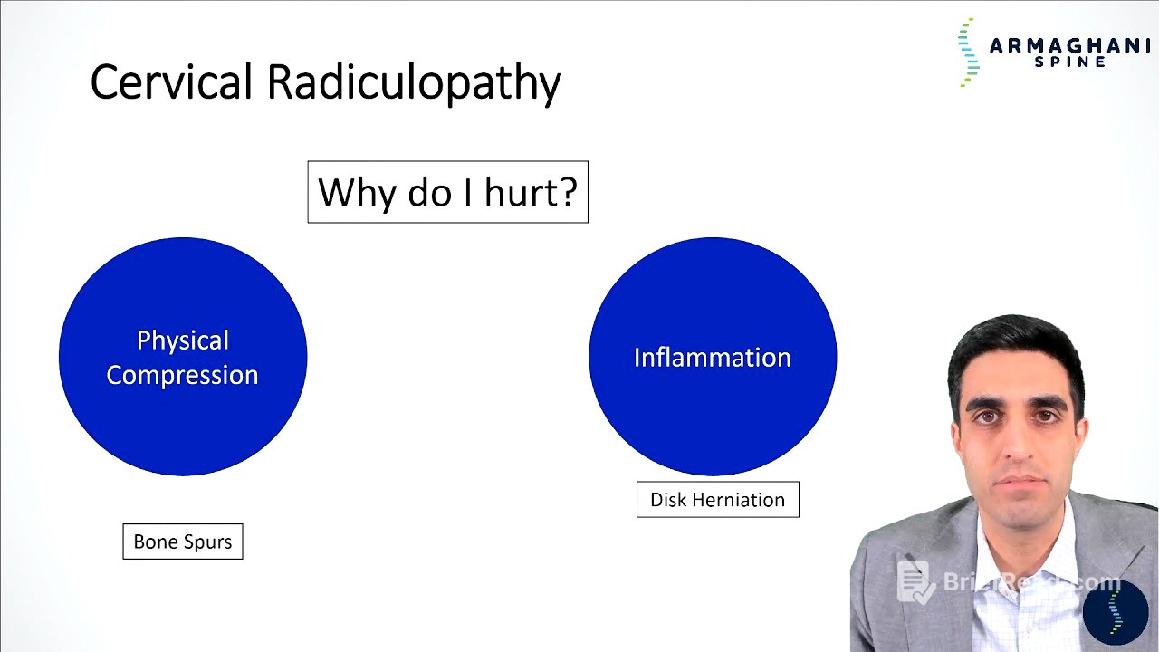 Cervical Radiculopathy - Why do you hurt and what is the plan to get you better?