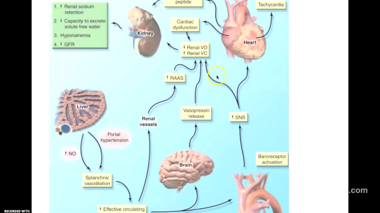 síndrome hepatorrenal