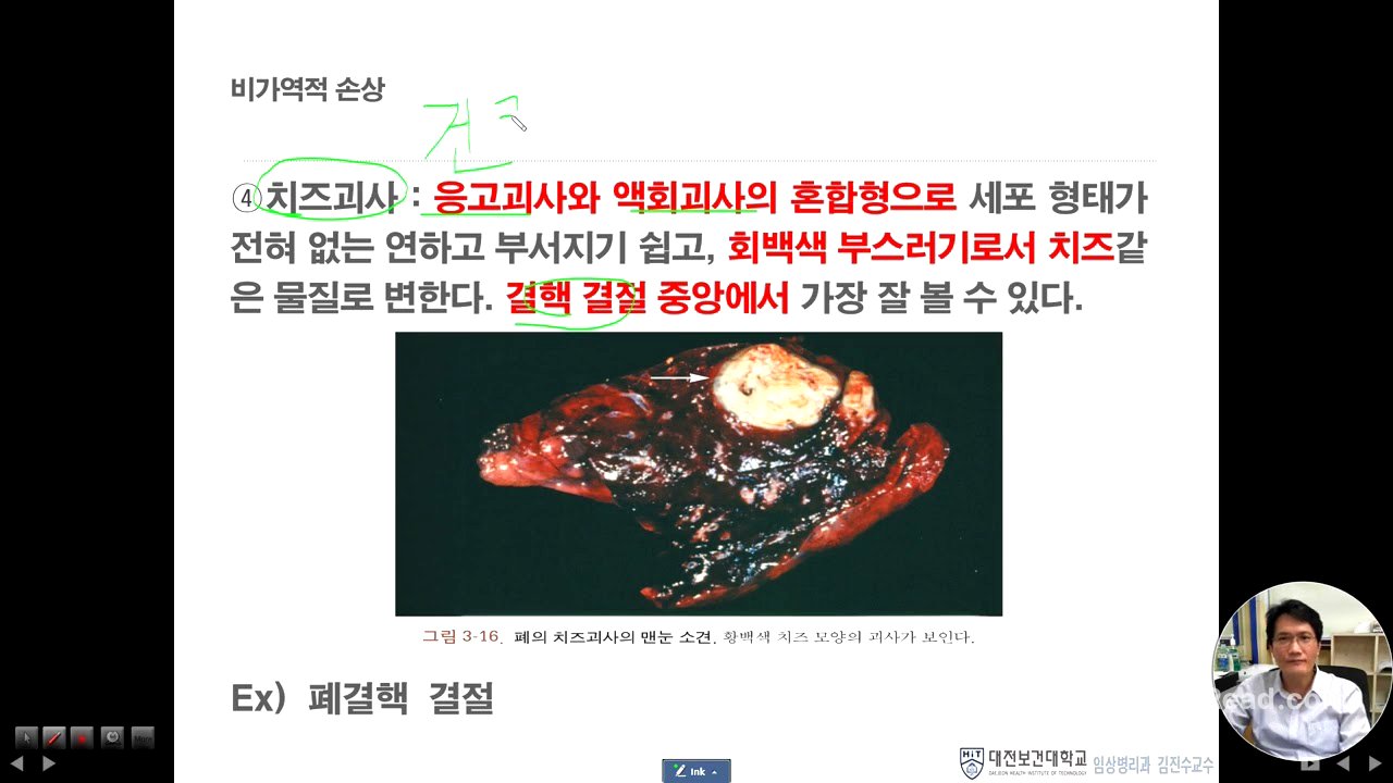 병리학6