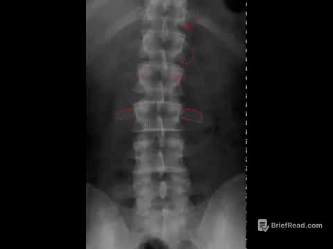Lumbar Spine Radiology Tutorial