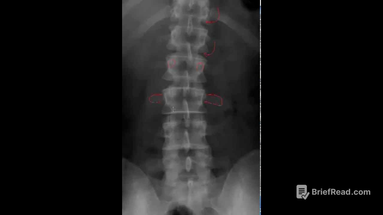 Lumbar Spine Radiology Tutorial