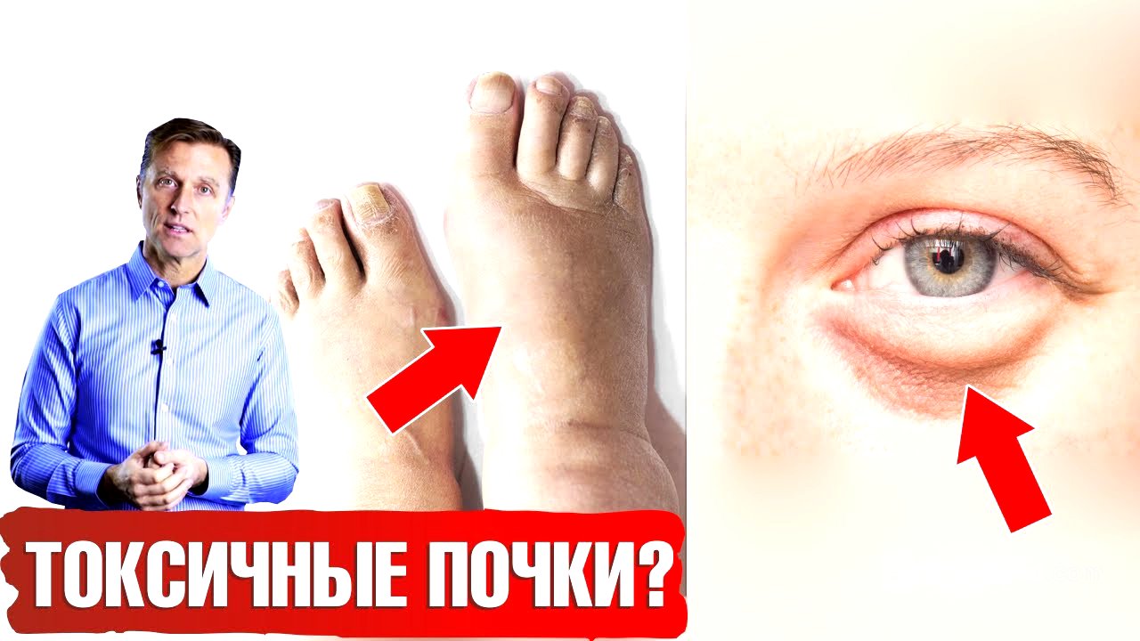 Болезни почек 👉 7 признаков. Лучшие и худшие продукты для почек