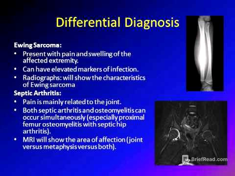 Osteomyelitis in children/ Bone infection in children