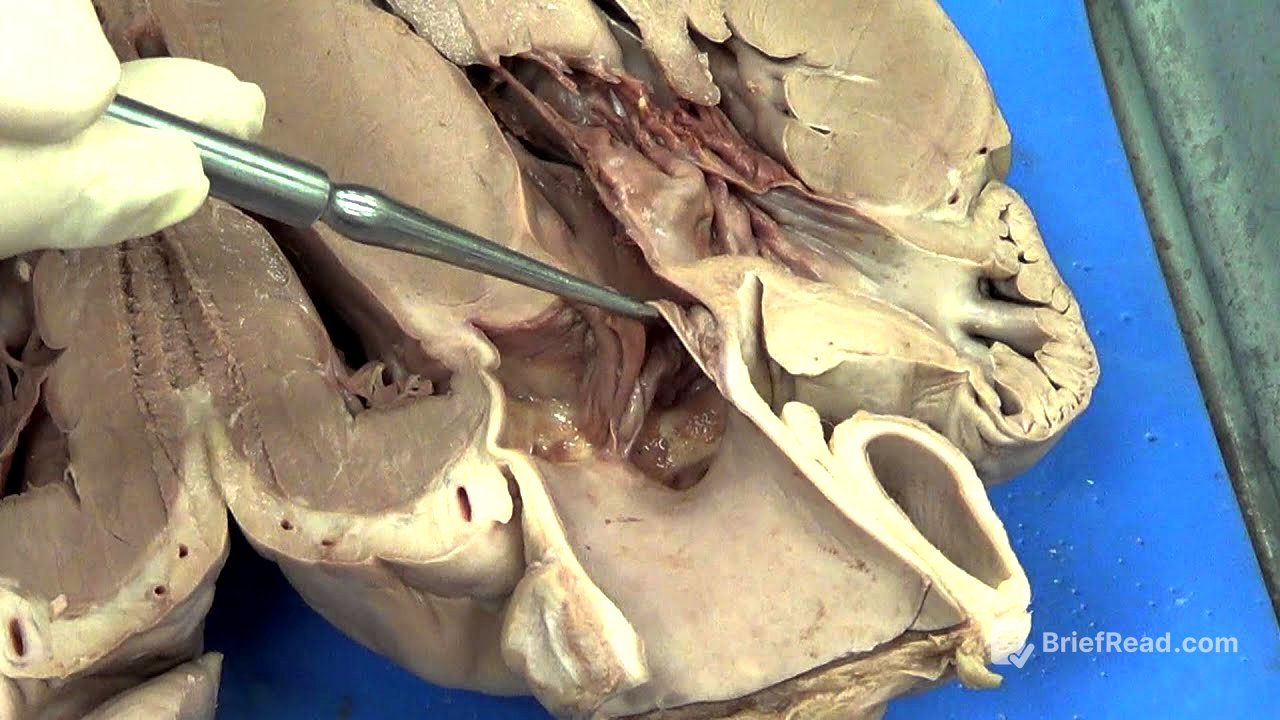 Heart dissection (Pig)