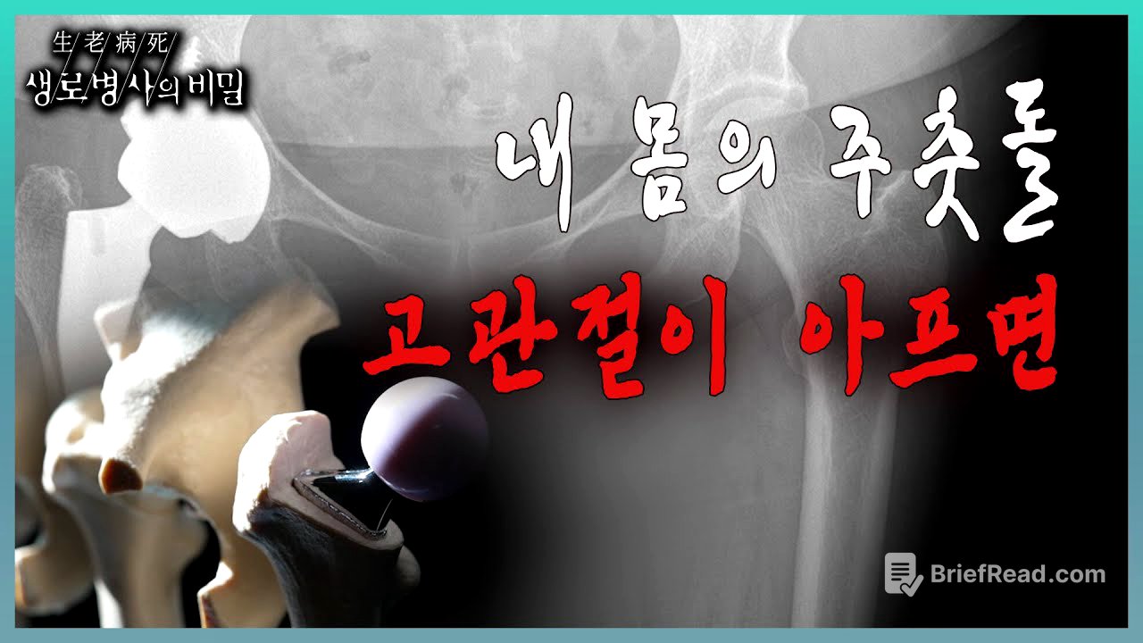 📌방송 하이라이트📌 고관절 뼈가 부러져서, 고관절에 병이 생겨서, 걷지 못하게 된 후에야 고관절의 중요성을 깨닫게 된 사람들을 만나본다 l KBS 20231115 방송