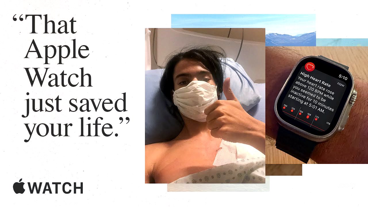 Dear Apple | Apple Watch