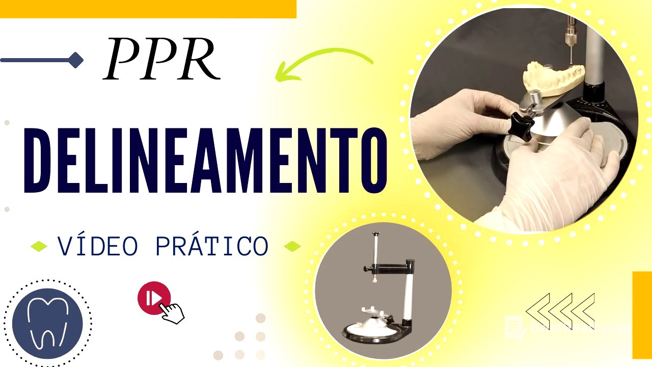 DELINEAMENTO PPR - Passos do planejamento