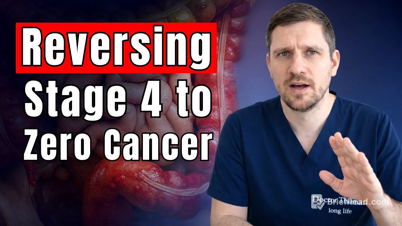 This Is Feeding Cancer Cells! How To Cut Off Cancer's Favorite Fuel