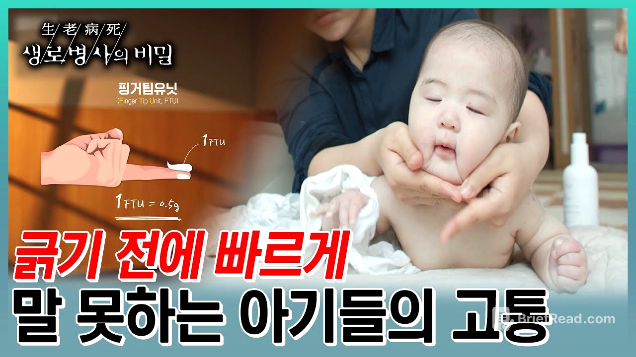 영유아기에 가장 많이 발현되는 아토피 피부염. 아기한테 스테로이드나 아토피 치료약을 쓰기가 두렵다고 마냥 피할수 없는 이유 (KBS 20230628 방송)
