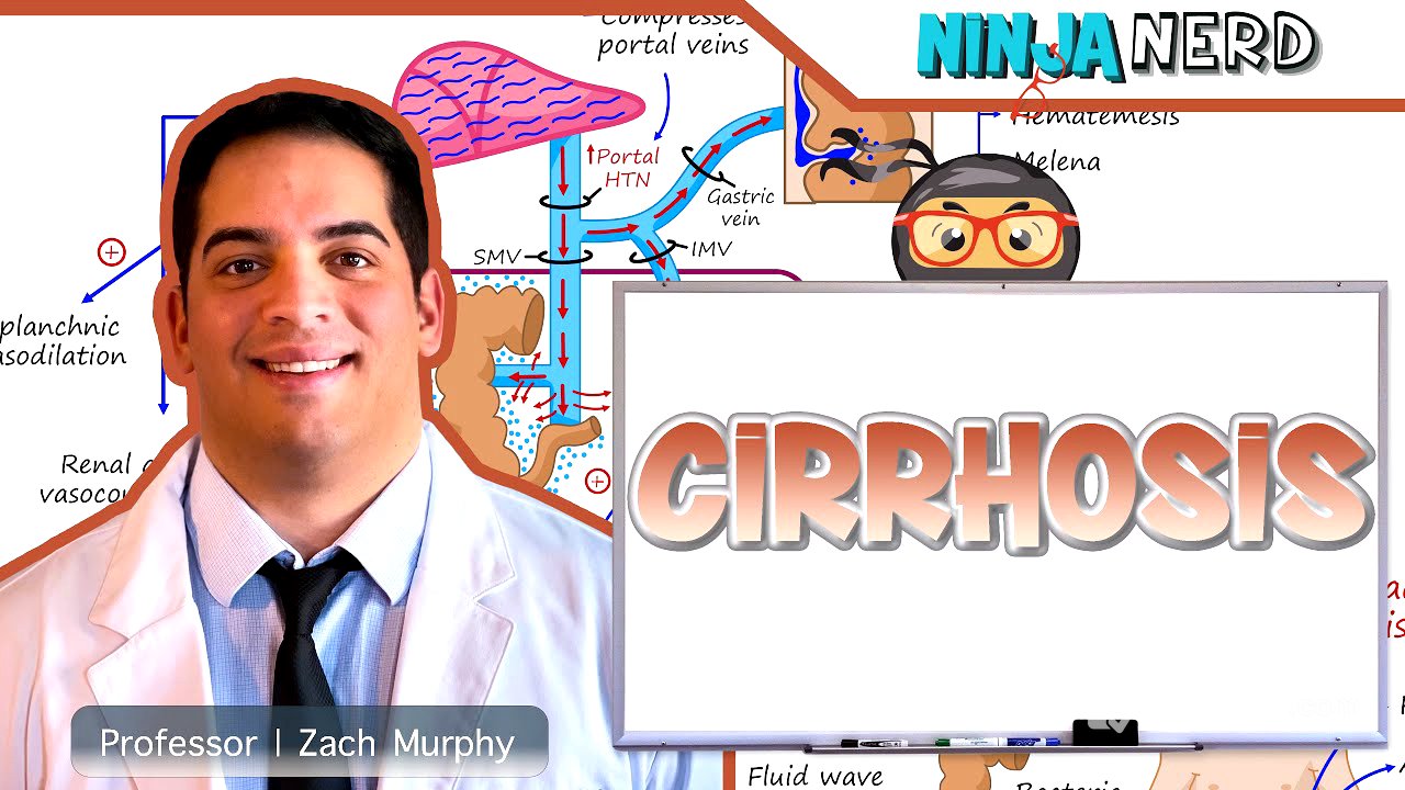 Cirrhosis | Clinical Medicine