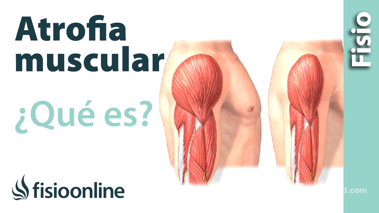 Atrofia muscular - Qué es y cómo sucede