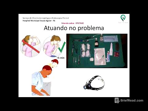 Epistaxe: como atuamos? (Epistaxis: how do we manage?)