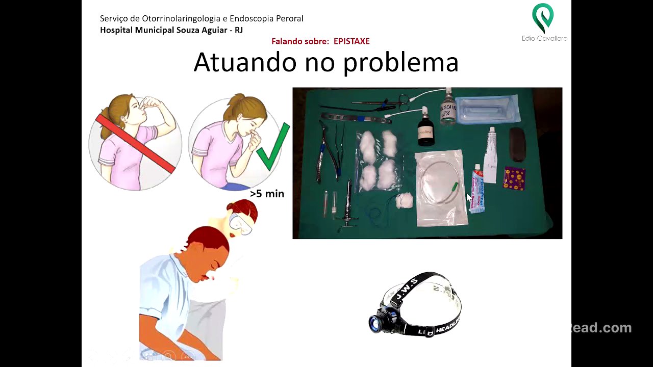 Epistaxe: como atuamos? (Epistaxis: how do we manage?)