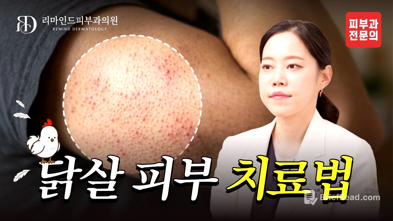 닭살 피부, 없앨 수 있다고? 피부가 오돌토돌했던 진짜 이유! 🐔