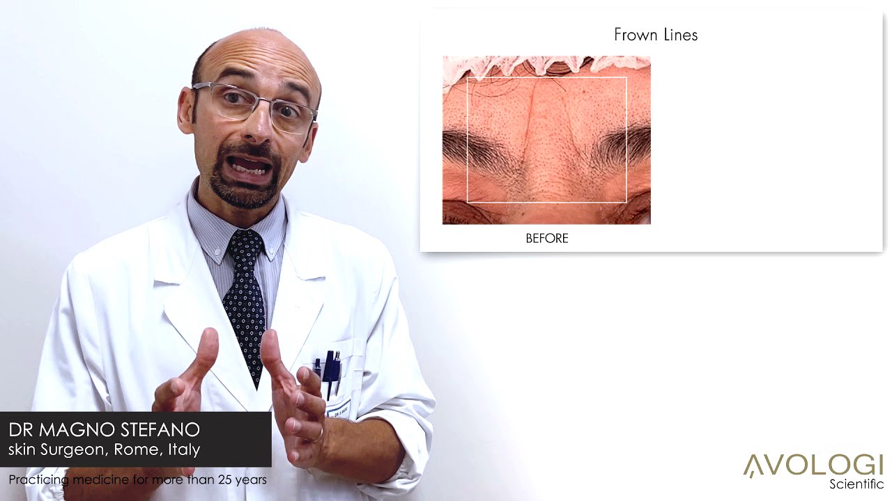 Avologi Eneo Totale review by Doctor Stefano Magno