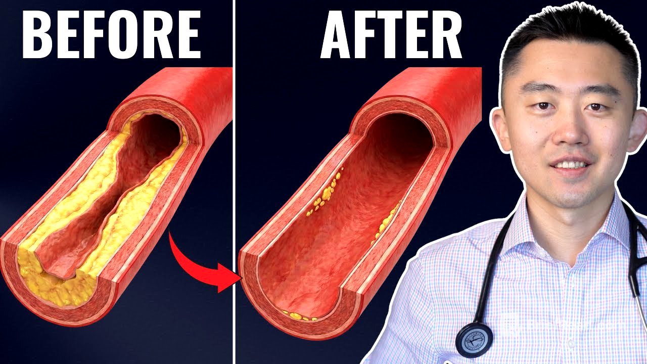 #1 Best Meal to UNCLOG Your Arteries (Backed by Science)