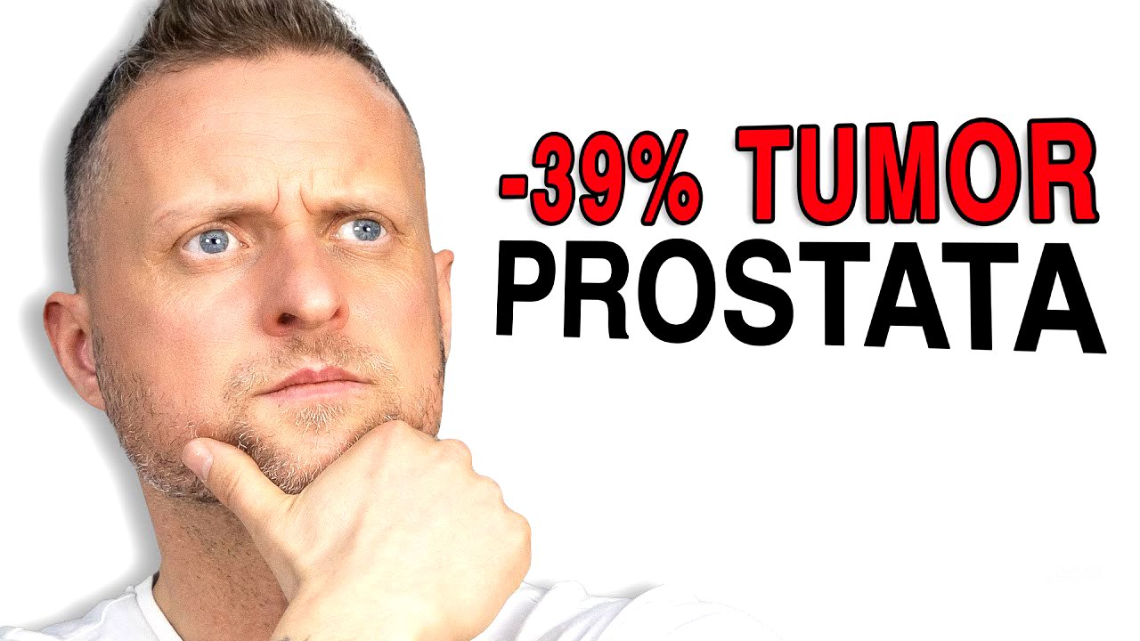 -39% Tumoraktivität: Dieser Stoff sagt Prostatakrebs den Kampf an! (Neue Studie)