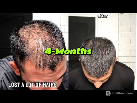 How I Reversed Hair Loss | 4 Months |  LifeOfNiravPatel