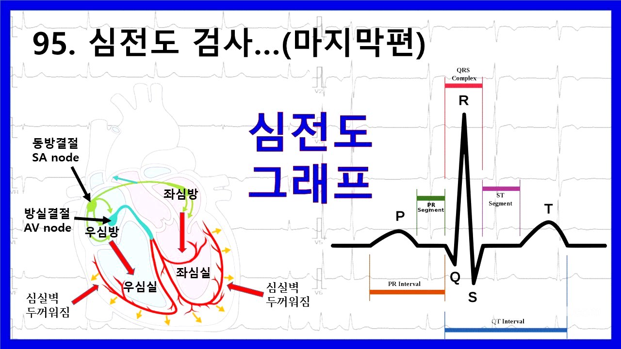 95. 심전도  검사에 대하여 - 심전도 그래프 설명