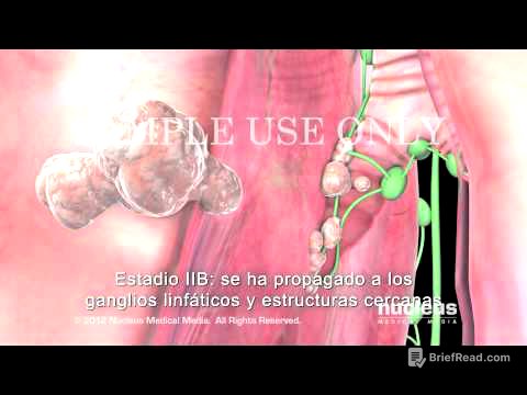 Progreso y estadificación del cáncer de pulmón