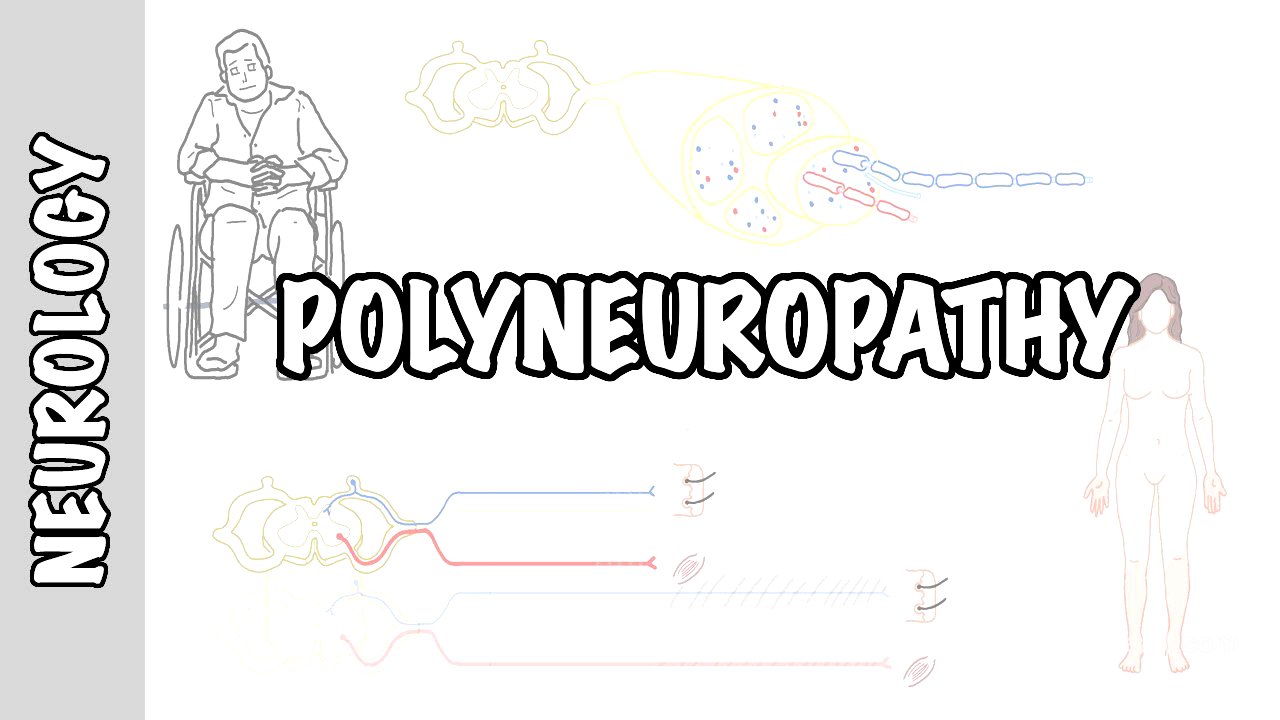 Approach to Polyneuropathy - causes, pathophysiology, investigations