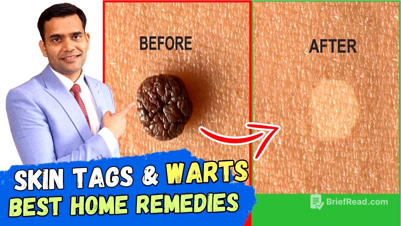 Skin Tags And Warts Will Disappear in 24 Hours - Dr. Vivek Joshi