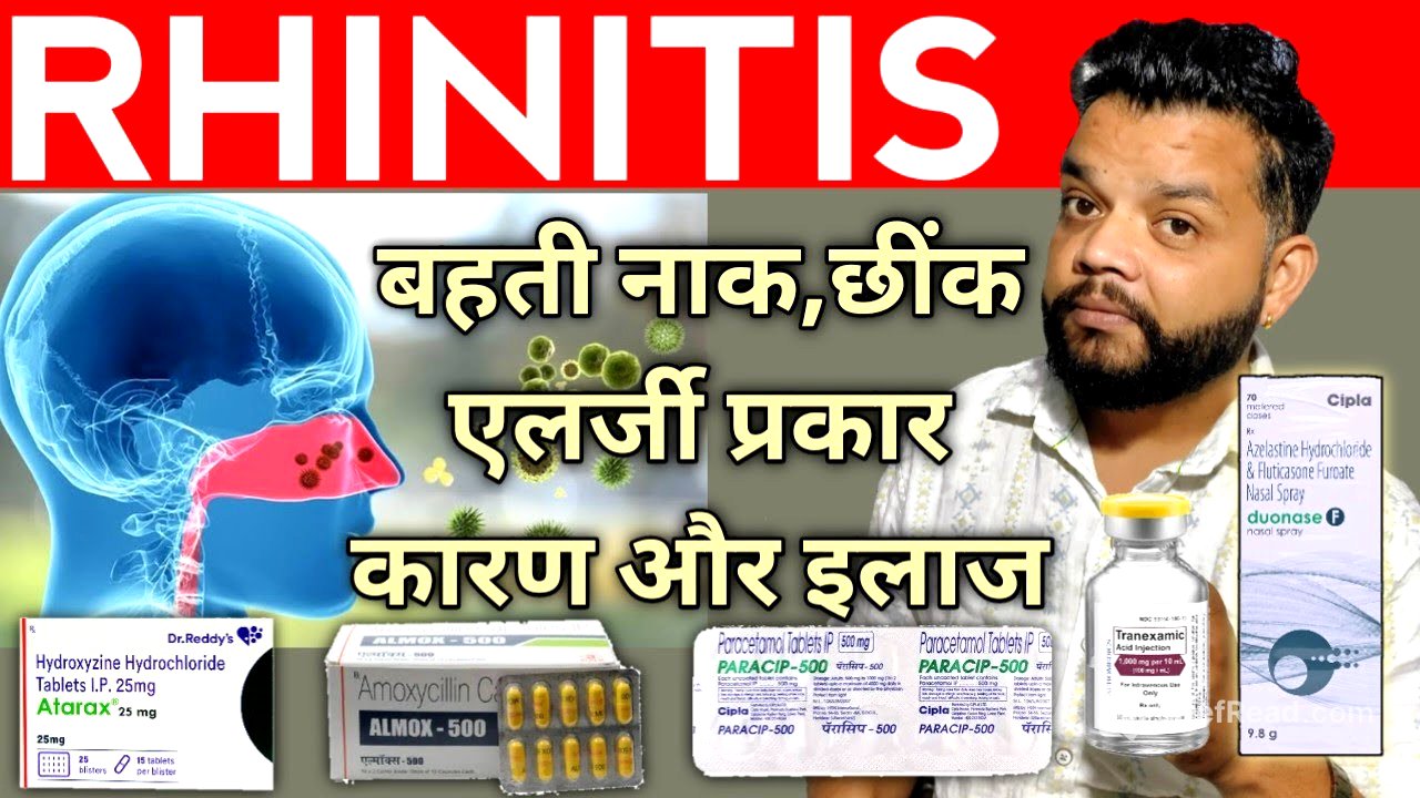 Rhinitis Complete Allopathic Treatment In Hindi | Rhinitis Causes, Symptoms And Treatment 