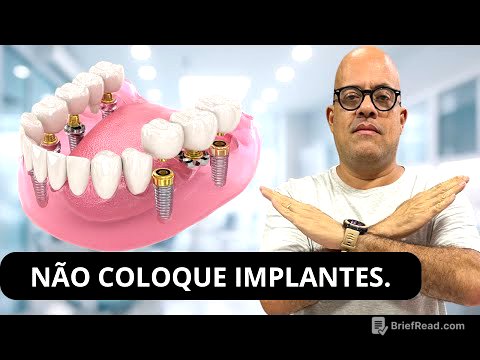 Não Coloque Implantes Antes De Saber Disso! Os Dentistas Não Te Contam A Verdade.