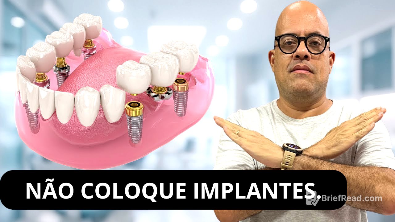 Não Coloque Implantes Antes De Saber Disso! Os Dentistas Não Te Contam A Verdade.