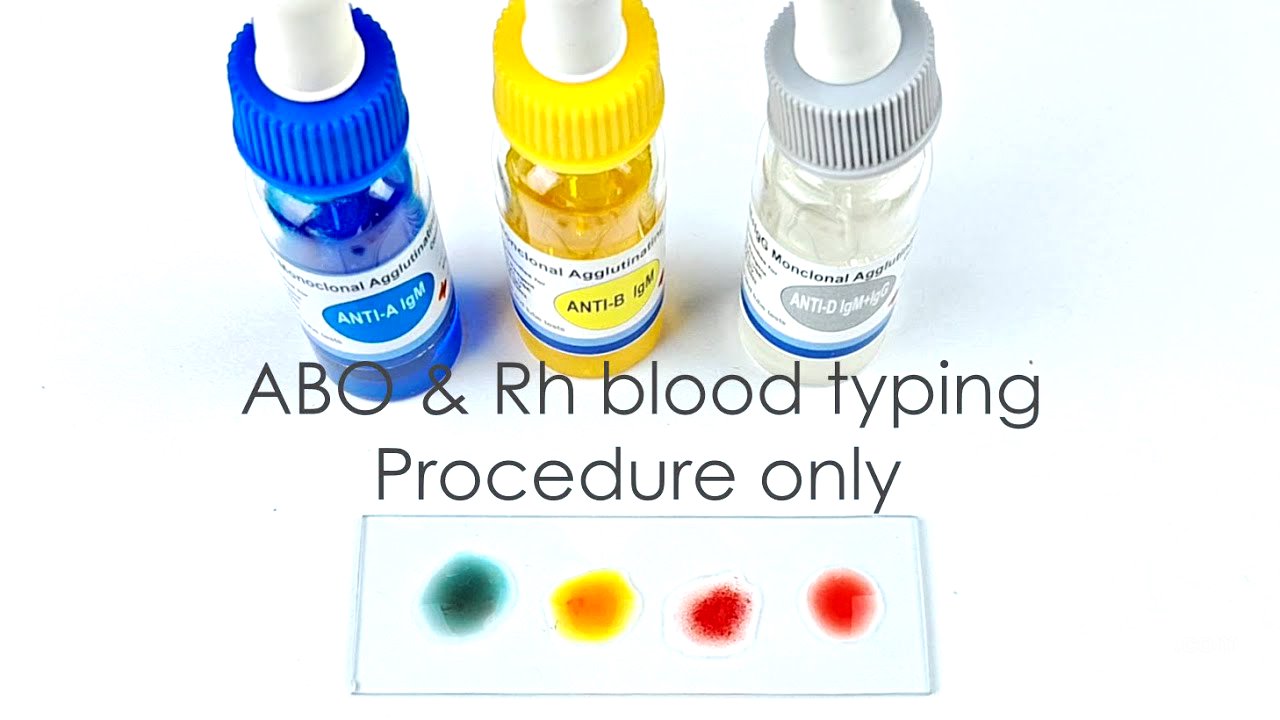 Abo Blood Grouping Test Procedure