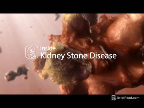 Medical Animation: Kidney Stone Disease