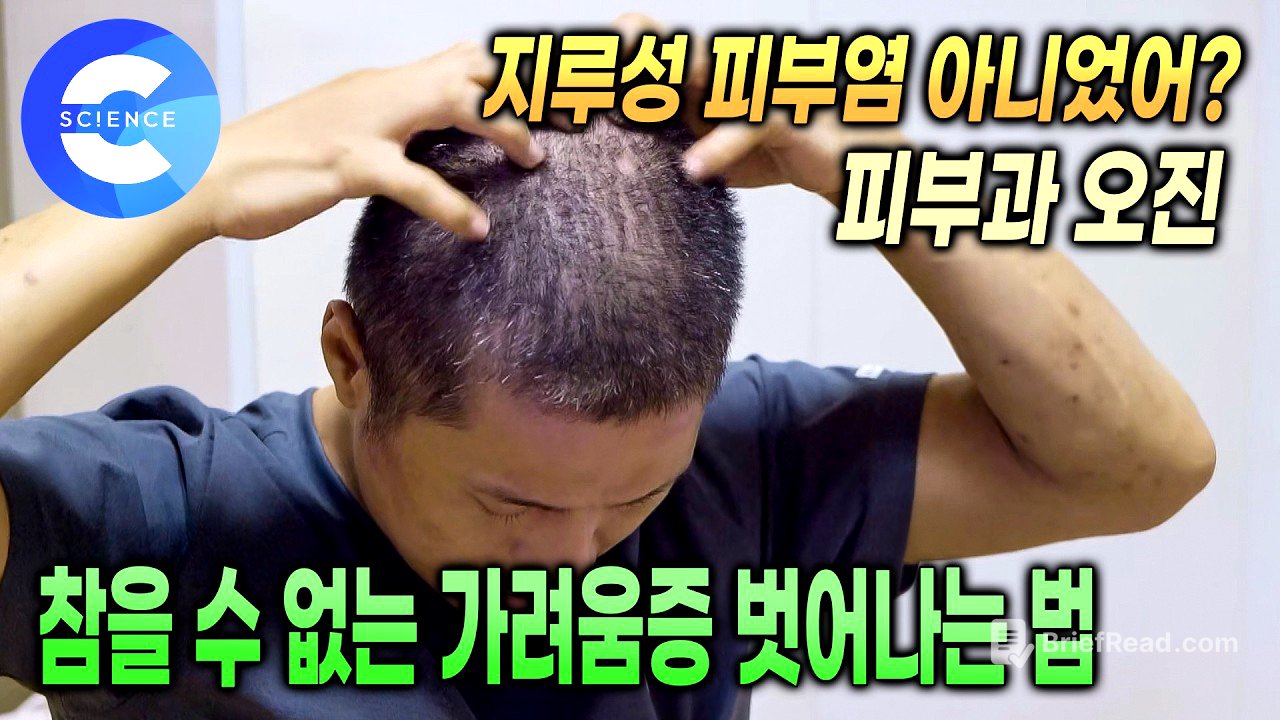 피부과 오진으로 5년 동안 잘못알고 있었던 두피질환 | 일상생활에 지장을 주는 심각한 두피질환, 치료 방법은 뭘까? | 올바른 샴푸 사용법 | 귀하신몸