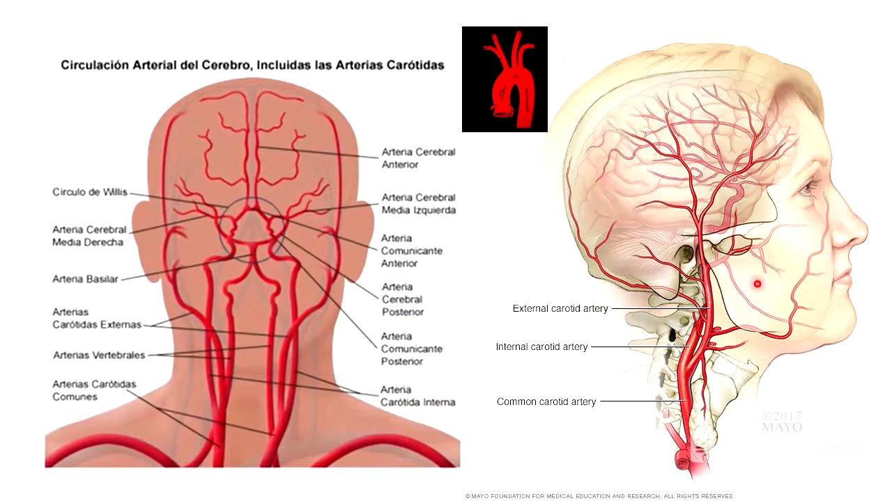 Anatomía vascular cabeza
