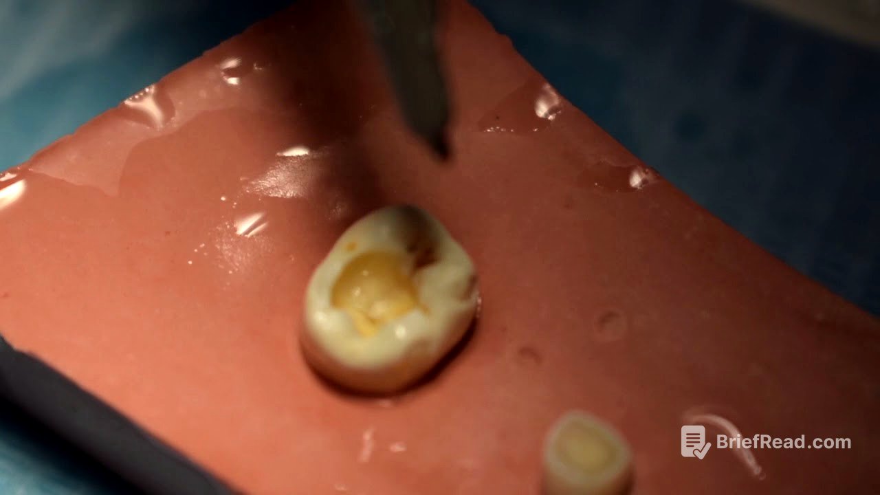 COMO REALIZAR UNA OBTURACIÓN CON COMPOSITE (EMPASTE)