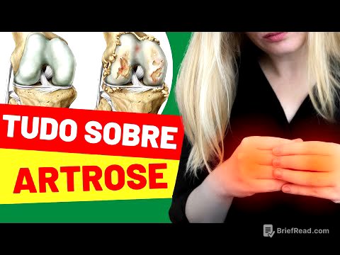 TUDO QUE VOCÊ PRECISA SABER SOBRE A ARTROSE!