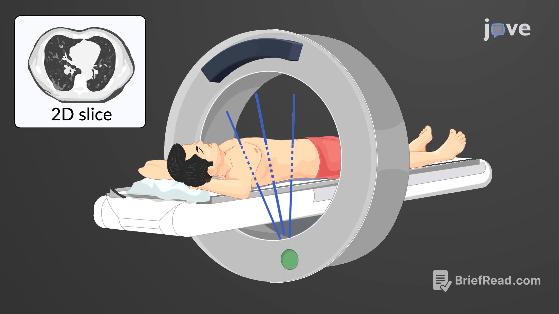 Video: Computed Tomography